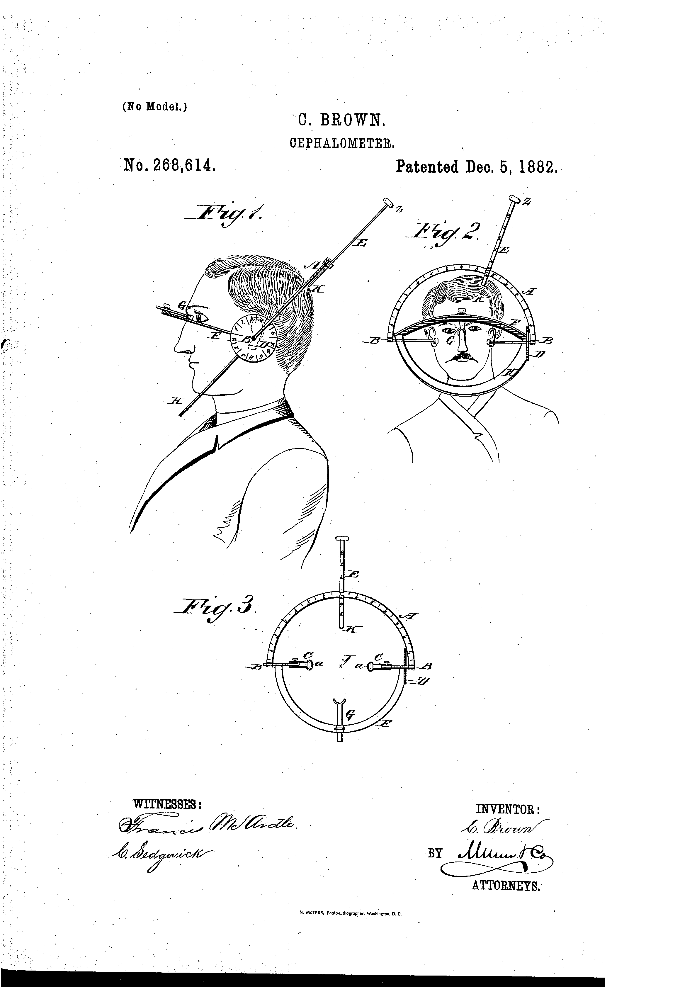 Today’s Patent- Cephalometer