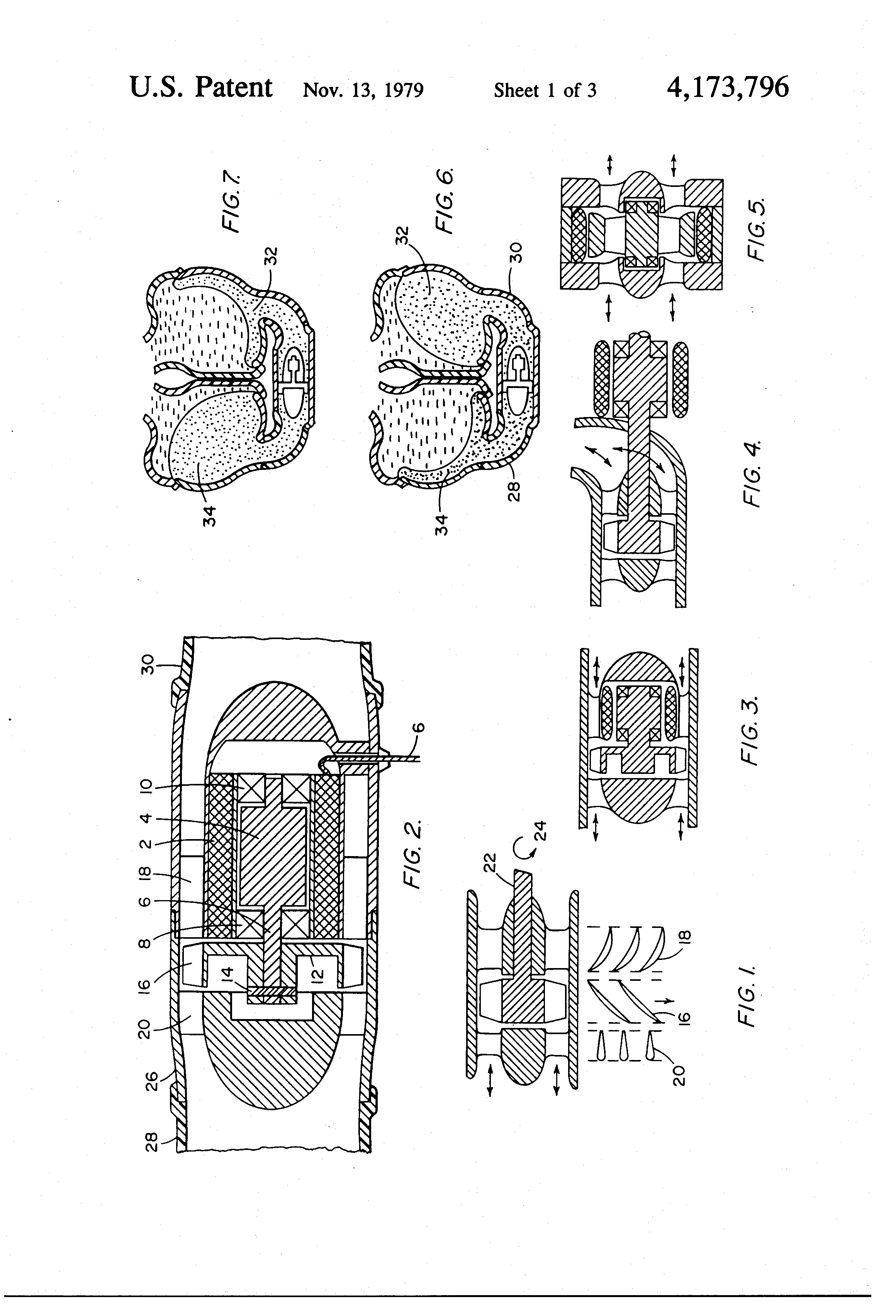 Patent of the week-Total artificial hearts and cardiac assist devices powered and controlled by reversible electrohydraulic energy converters