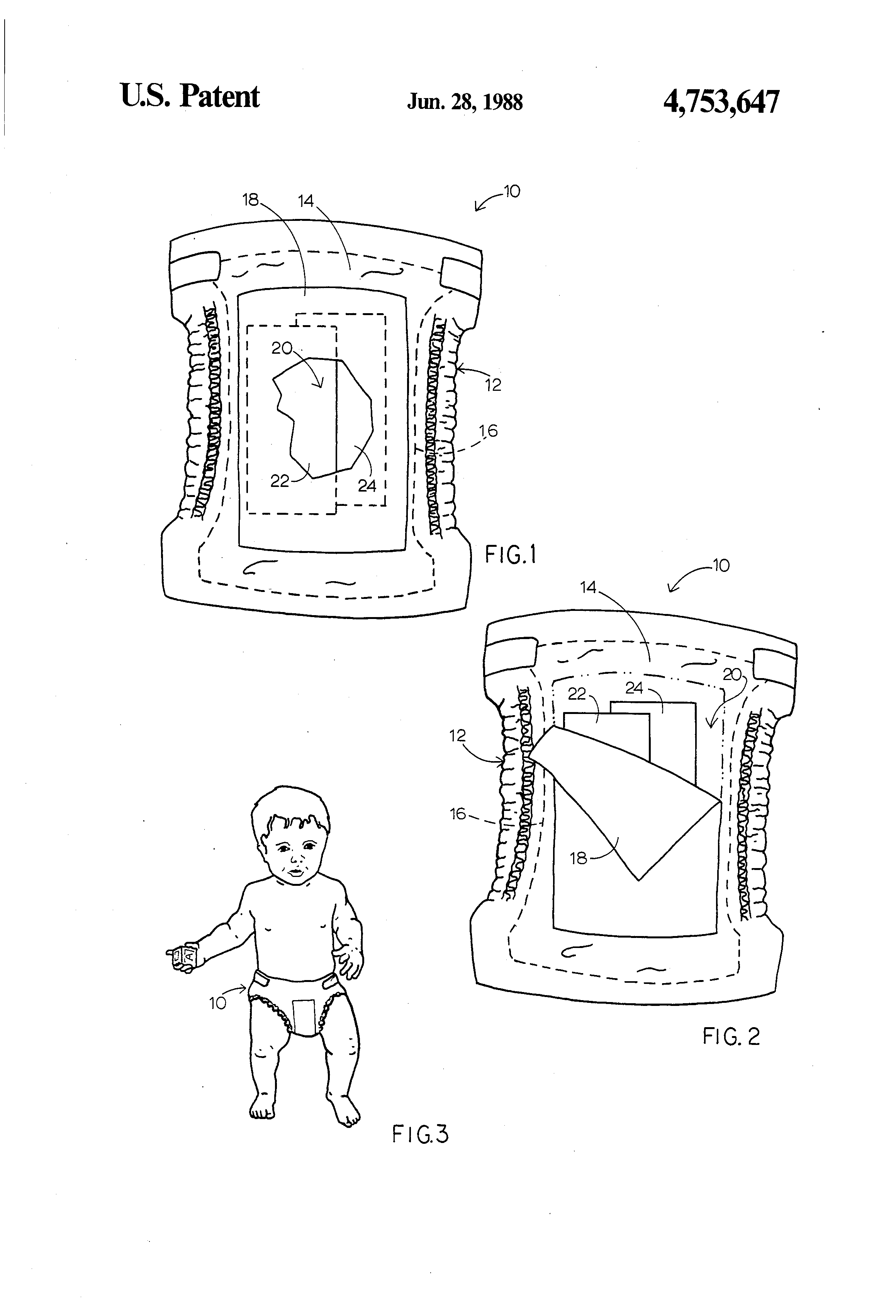 TODAY’S PATENT- INFANT GARMENT
