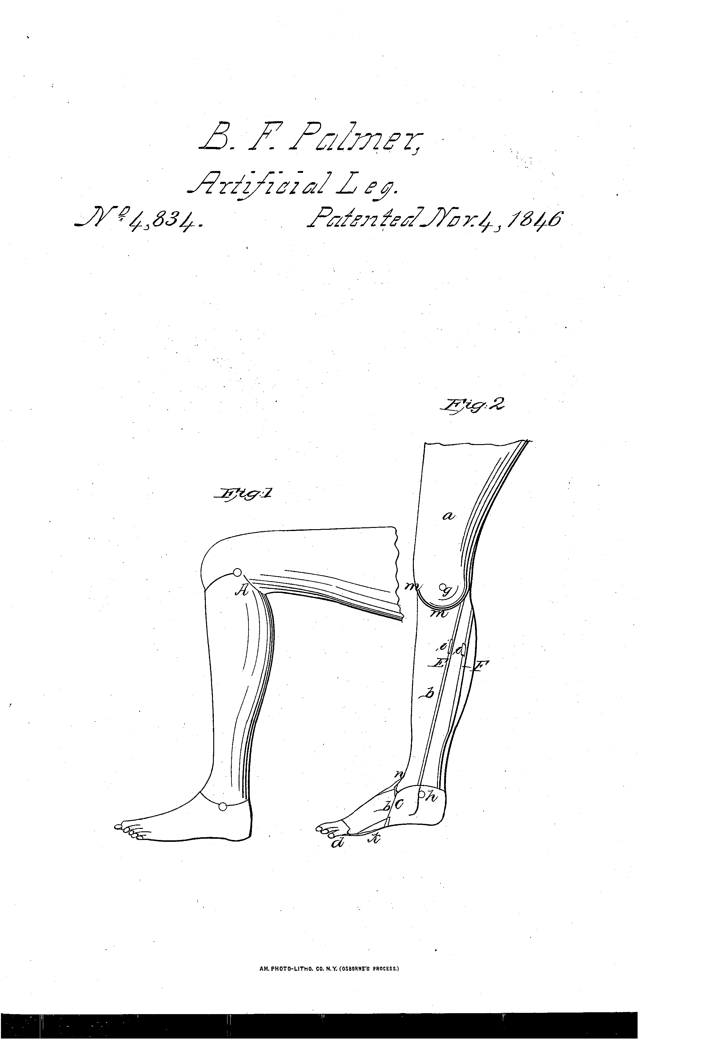 Today’s Patent- Artificial Leg